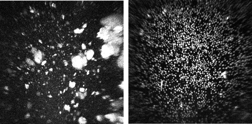 Cristales del fármaco pembrolizumab producidos en la Tierra (izquierda) y en el espacio (derecha). En ausencia de gravedad, se obtienen cristales mucho más uniformes y homogéneos. <a href="https://www.nature.com/articles/s41526-019-0090-3/figures/3" rel="nofollow noopener" target="_blank" data-ylk="slk:Merck/Nature;elm:context_link;itc:0;sec:content-canvas" class="link ">Merck/Nature</a>, <a href="http://creativecommons.org/licenses/by/4.0/" rel="nofollow noopener" target="_blank" data-ylk="slk:CC BY;elm:context_link;itc:0;sec:content-canvas" class="link ">CC BY</a>