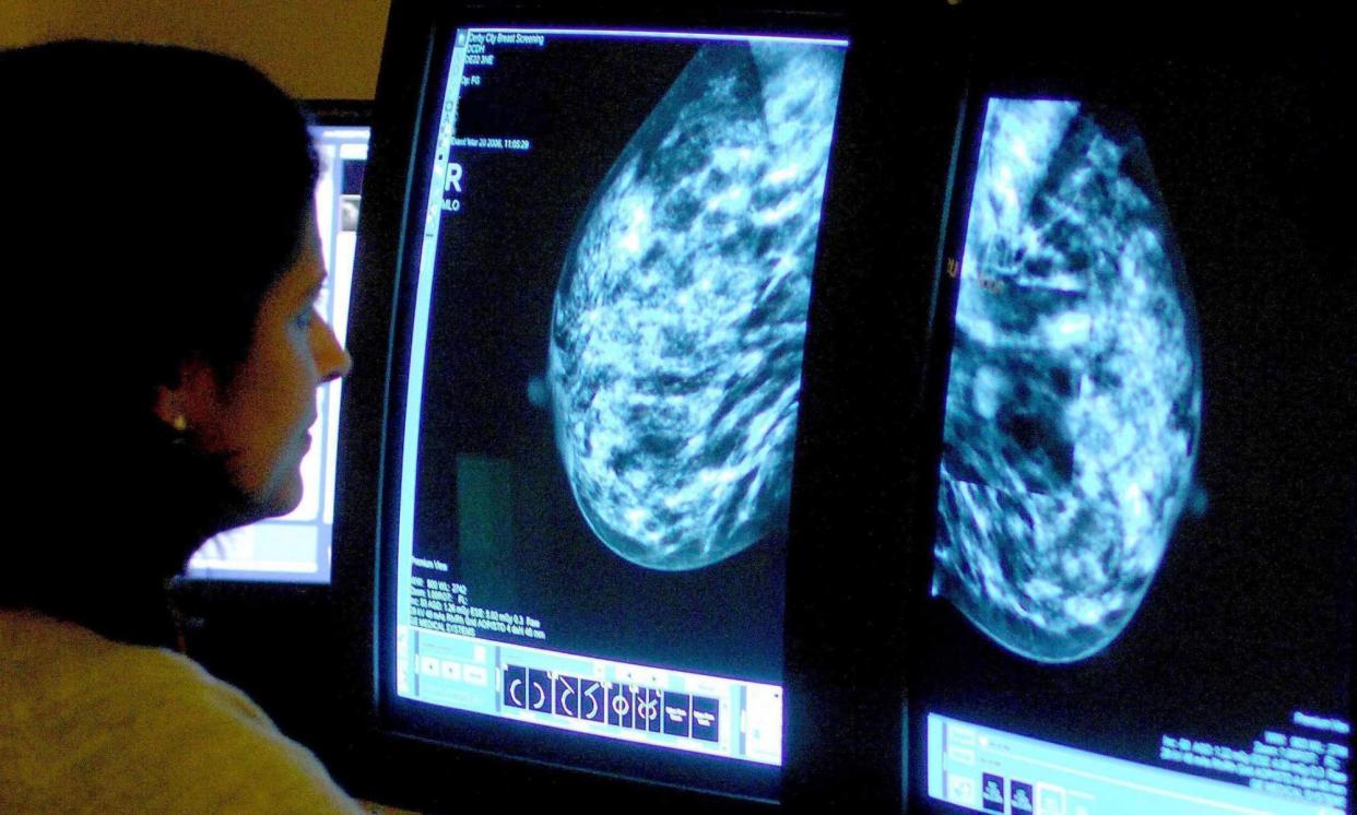 <span>Pembrolizumab could be used alongside chemotherapy before and after surgery to treat a common form of breast cancer.</span><span>Photograph: Rui Vieira/PA</span>