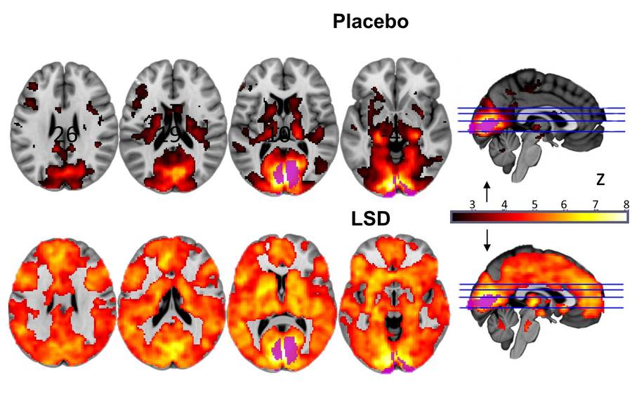 This Is Your Brain on LSD, in One Incredible Chart