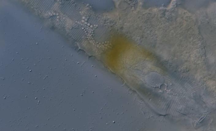 Microfoto van kleine bolletjes olie in het darmkanaal van een gezichtsmijt.