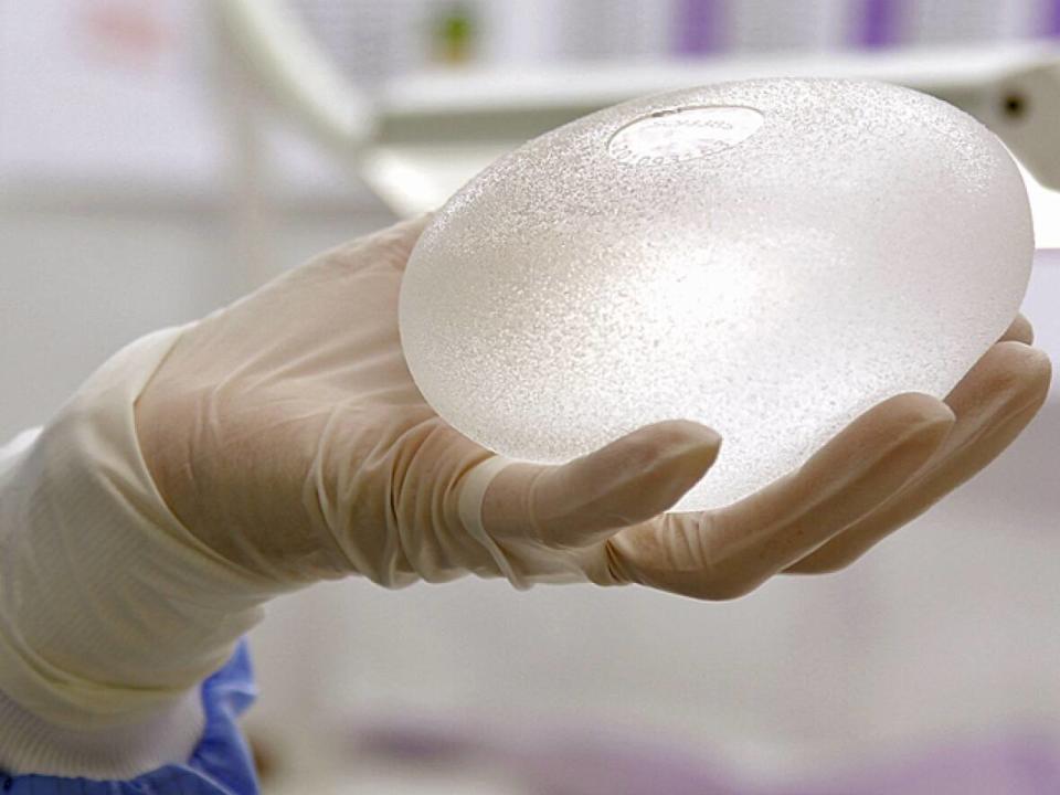 A House of Commons health committee is studying the feasibility of a national breast implant registry, something advocates have been calling for since the 1990s. (Benoit Tessier/Reuters - image credit)