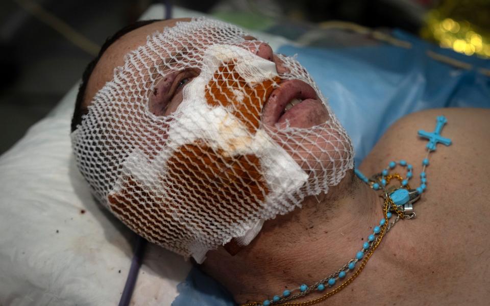 A wounded Ukrainian soldier lays on the operating table at a medical stabilisation point near Bakhmut