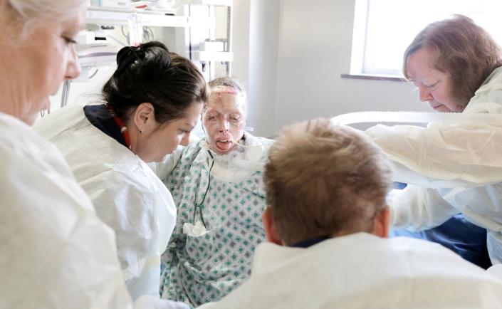 Patru asistente o ajută pe Judy Malinowski să intre în patul ei de spital în 2016. Anul precedent, Malinowski, care avea 32 de ani, a fost stropită cu benzină și incendiată de fostul ei iubit, Michael Slager.  Timp de 22 de luni, mama a doi copii a supraviețuit înainte de a ceda rănilor în iunie 2017.