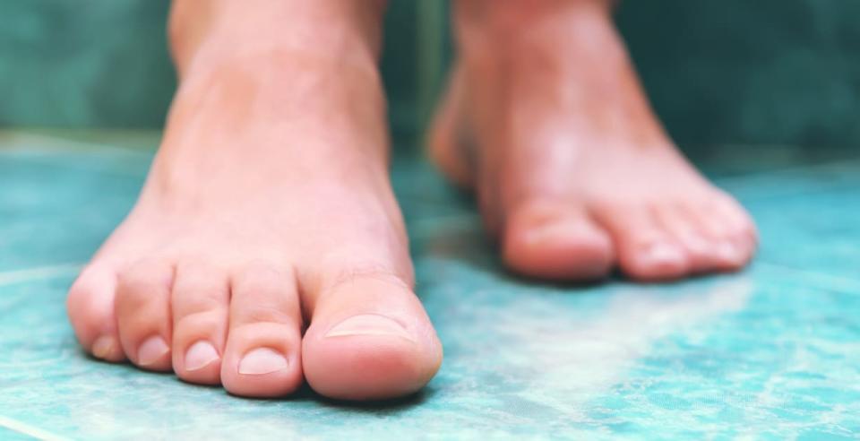 How to prevent and treat toenail fungus. Onychomycosis symptoms, risk factors, and treatment explained 