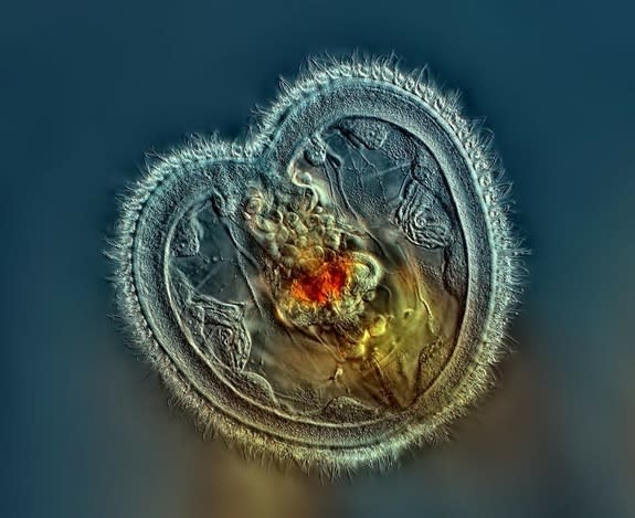 Rogelio Moreno of Panama took this photo looking at a rotifer's open mouth.