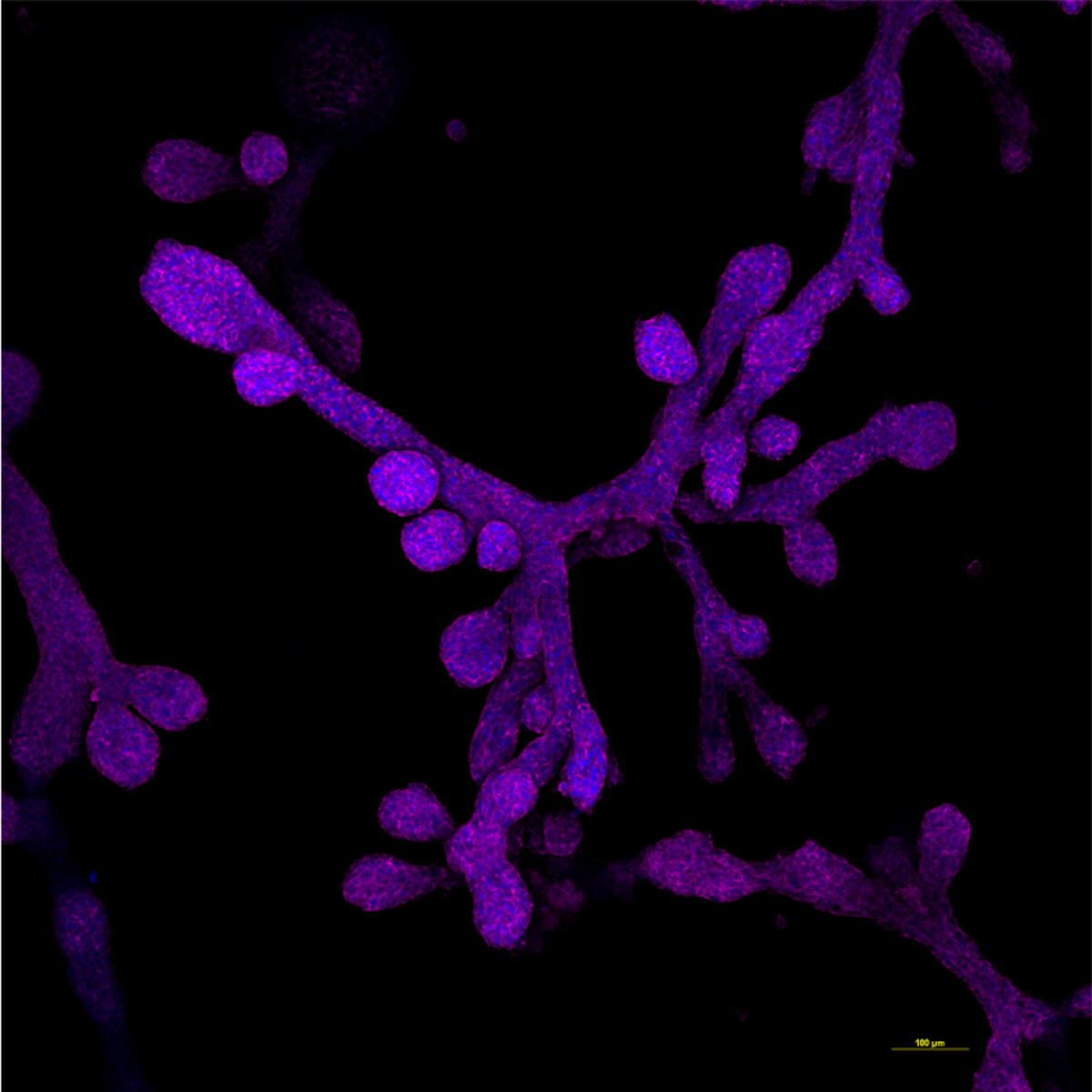 Mammary glands in a dish − what miniature organs reveal about evolution, lactation, regeneration and breast cancer