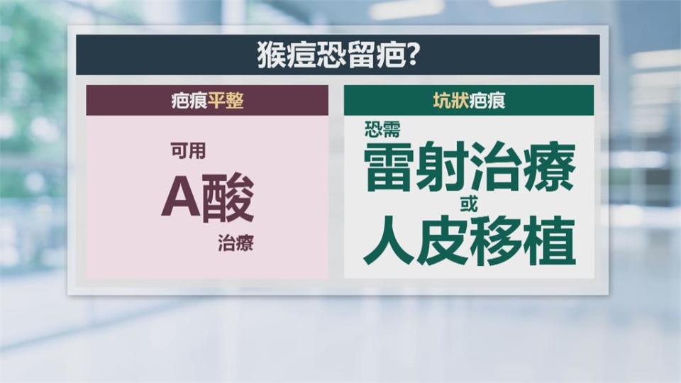 染猴痘洗衣加漂白　羅一鈞：別用快洗、別省水