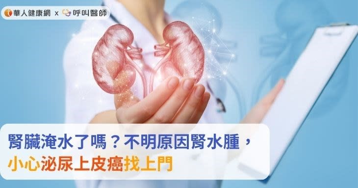 腎臟淹水了嗎？不明原因腎水腫，小心泌尿上皮癌找上門