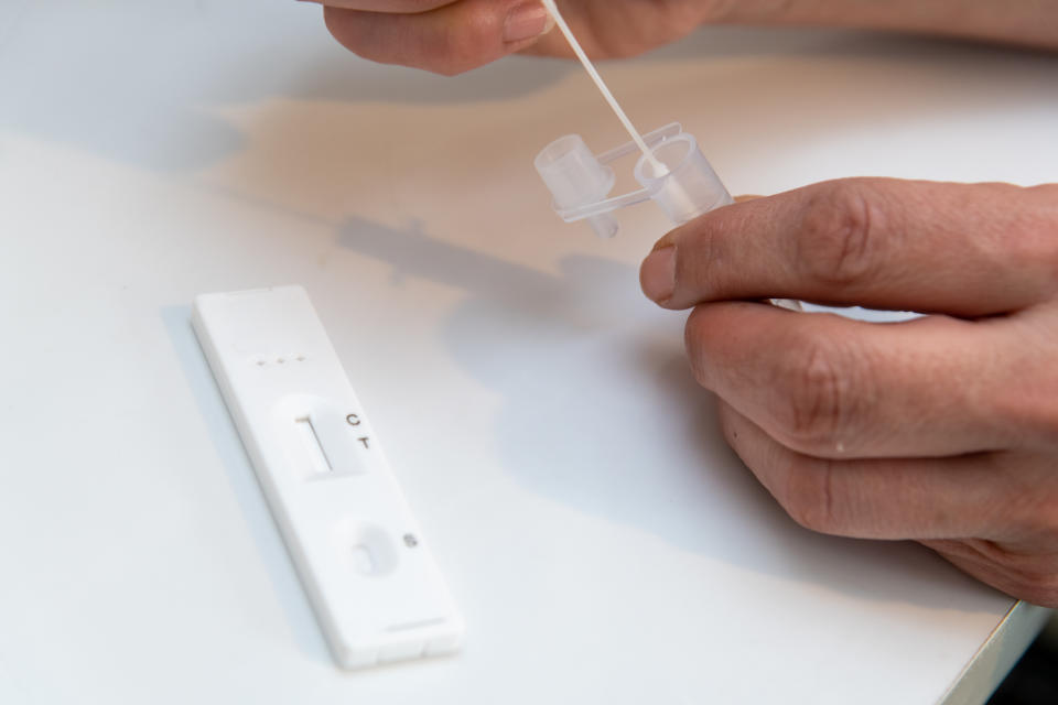 COVID-19 rapid test kit is a qualitative lateral flow immunochromatographic assay for the detection of IgM and IgG antibodies to SARS-CoV-2 in human whole blood, serum or plasma samples