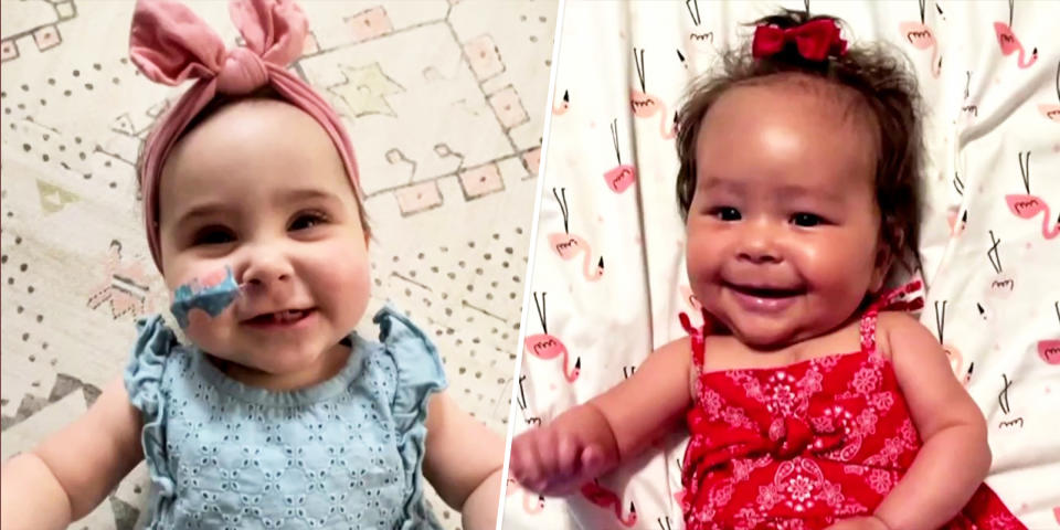 Baby Mia Skaats (left) needed a new heart, even though her heart valves worked well. Baby Brooklyn Civil needed a new heart valve. The two will share a connection for life, as Mia donated her heart valve to Brooklyn after Mia got a new heart. (TODAY)