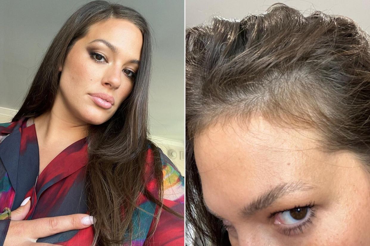 Ashley Graham Shows Progress of Her Hairline Growing Back in After It Fell Out Following Her Pregnancy