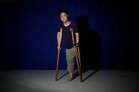 North Korean defector Ji Seong-ho, 35, poses for a photograph leaning on the crutches he used when he defected, in Seoul, South Korea, August 13, 2017. REUTERS/Kim Hong-ji