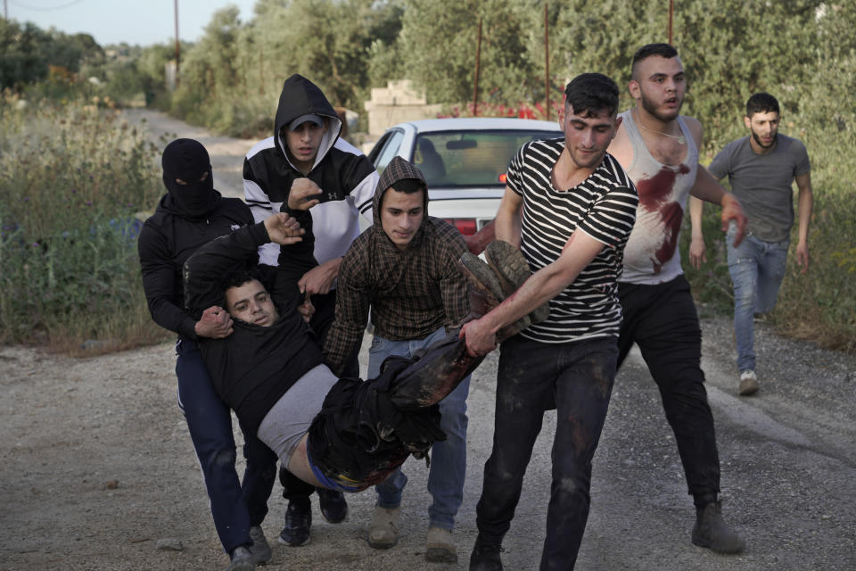 Palestinians carry a wounded man during clashes with Israeli soldiers, in the West Bank village of Silat al-Harithiya, near Jenin, Saturday, May 7, 2022, as Israeli forces demolished the home of Omar Jaradat was part of a group who shot and killed yeshiva student Yehuda Dimentman in the West Bank in Decelmer 20221. (AP Photo/Majdi Mohammed)