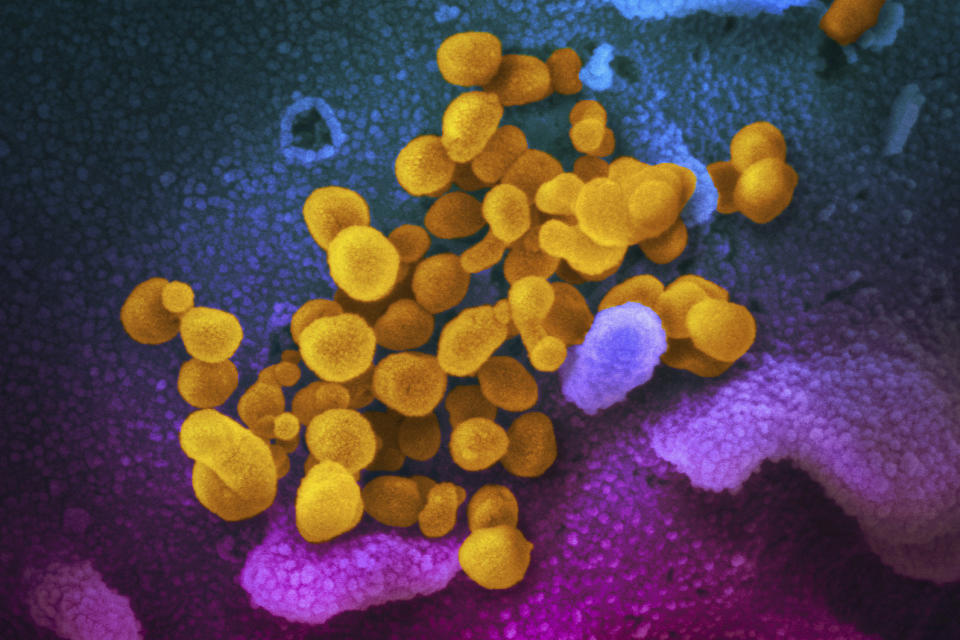 This undated electron microscope image made available by the U.S. National Institutes of Health in February 2020 shows the Novel Coronavirus SARS-CoV-2, yellow, emerging from the surface of cells, blue/pink, cultured in the lab. Also known as 2019-nCoV, the virus causes COVID-19. On Friday, April 3, 2020, The Associated Press reported on stories circulating online incorrectly asserting that eating alkaline foods will stave off the novel coronavirus, which has a pH level of 5.5 to 8.5. Donald Schaffner, extension specialist in food science at Rutgers University, told the AP. “The human body is designed to be really good at maintaining its pH. … the best way to keep from getting a virus is to stay away from people.” (NIAID-RML via AP)