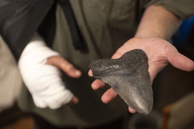 <p>Andrew J. Whitaker/The Post And Courier via AP</p> Will Georgitis holds up a megalodon tooth he found the day he was attacked by an alligator