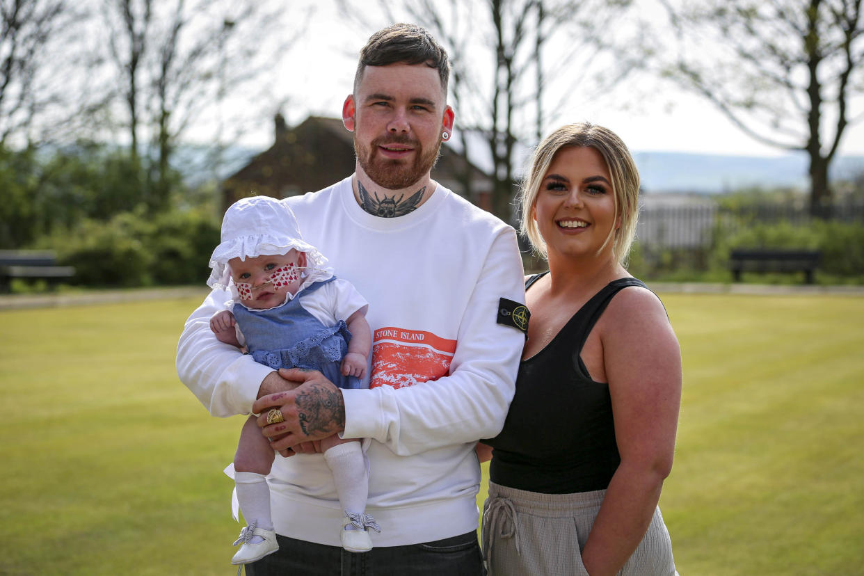 A premature baby born at 23 weeks is now thriving at home. Elsie pictured with her parents Katie and Rob Hampson. (Image supplied/SWNS)