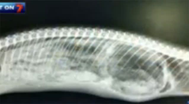 An X-ray showed that there was a bear in there. Source: 7 News.