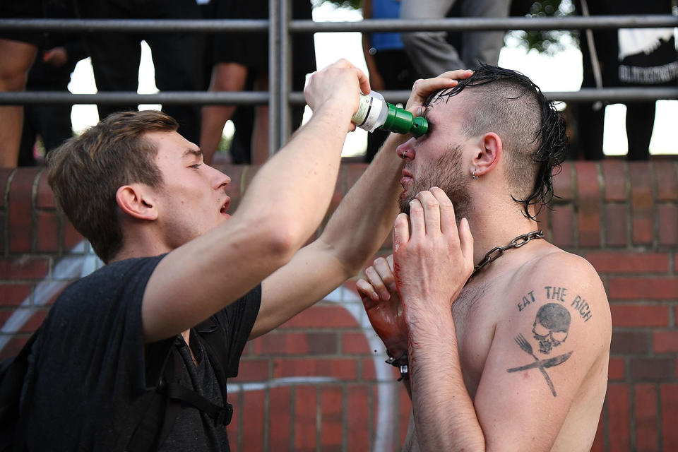 <p>A man washes another man’s eye after suspected tear gas use during the “Welcome to Hell” protest march on July 6, 2017 in Hamburg, Germany. (Photo: Leon Neal/Getty Images) </p>