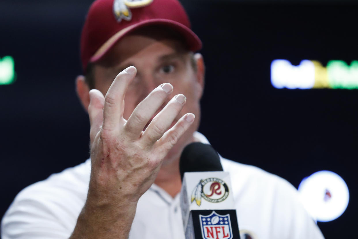 Washington head coach Jay Gruden searching for answers. (AP Photo/Alex Brandon)