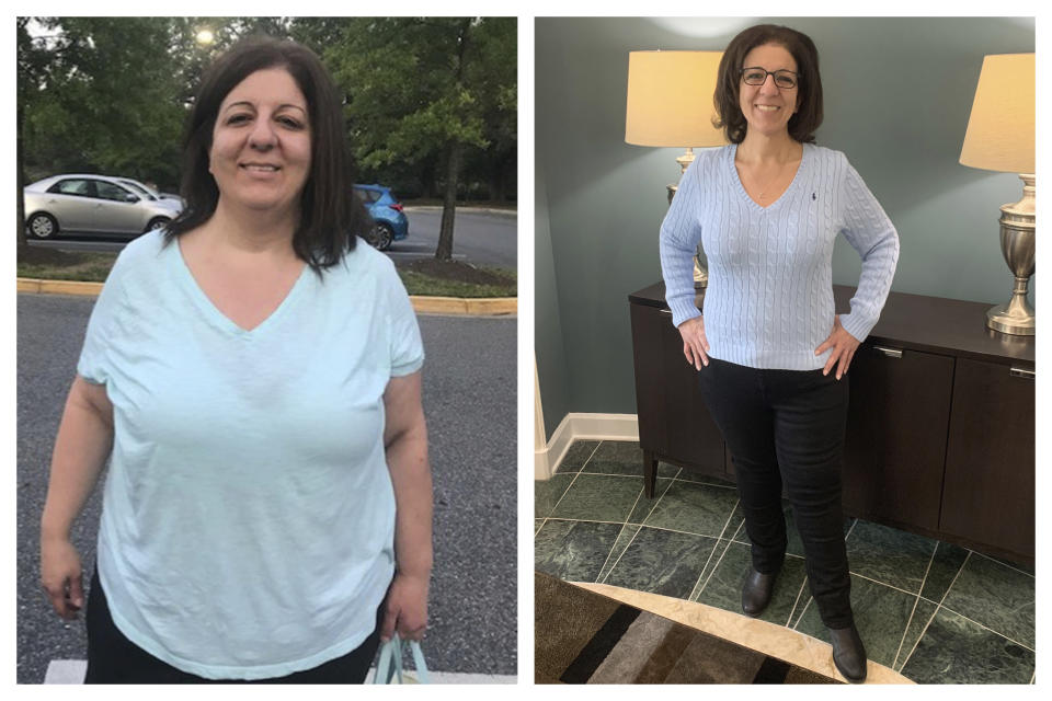 This combination of photos provided by Anita Saah shows her on the morning before her sleeve gastrectomy surgery in July 2018 at the Shady Grove Adventist Hospital in Rockville, Md., left, and at her apartment building in Rockville in January 2020. After experiencing symptoms such as severe dehydration, likely related to her previous acid reflux, she went back for a different weight loss surgery in September 2019. (Helen Kassa, E. Slaten via AP)