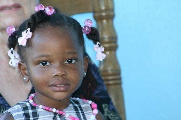 Two-year-old Mishna Prezille waiting to fly from Haiti to the U.S. in 2010 for surgery to her feet.