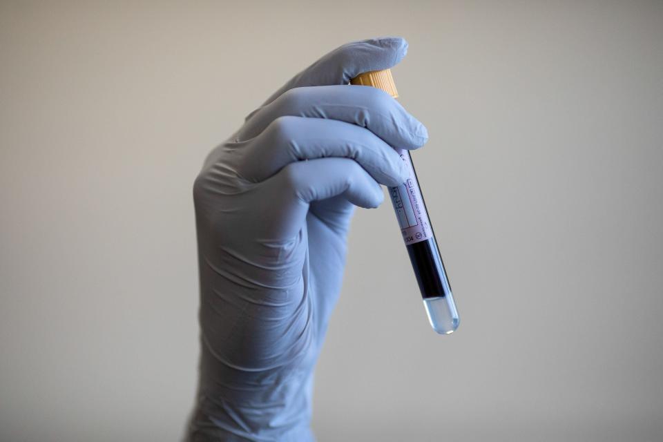 A paramedic holding a test tube containing a blood sample (PA)