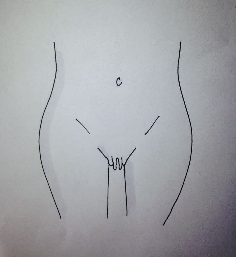 2) Types of vaginas: Prominent inner lips