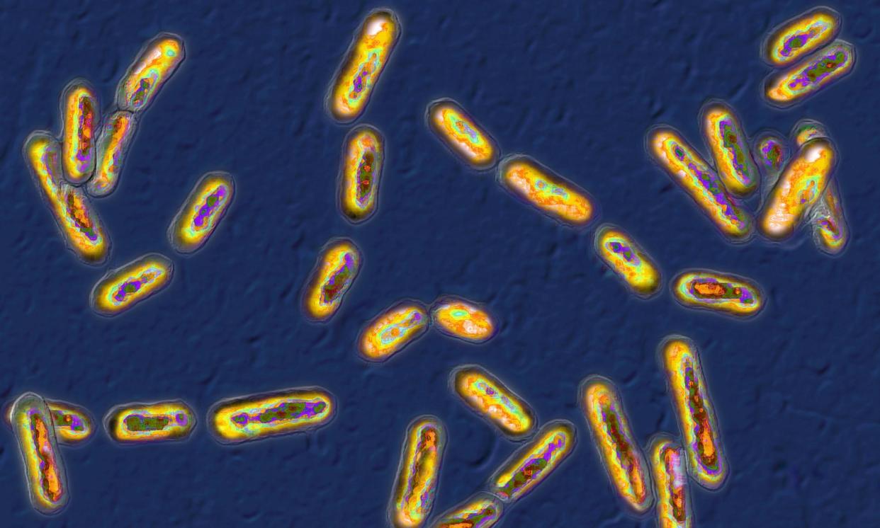 <span><em>Clostridium difficile</em>, a bacterium that causes diarrhoea, was among pathogens found in airborne dust particles.</span><span>Photograph: BSIP/Universal Images Group/Getty Images</span>