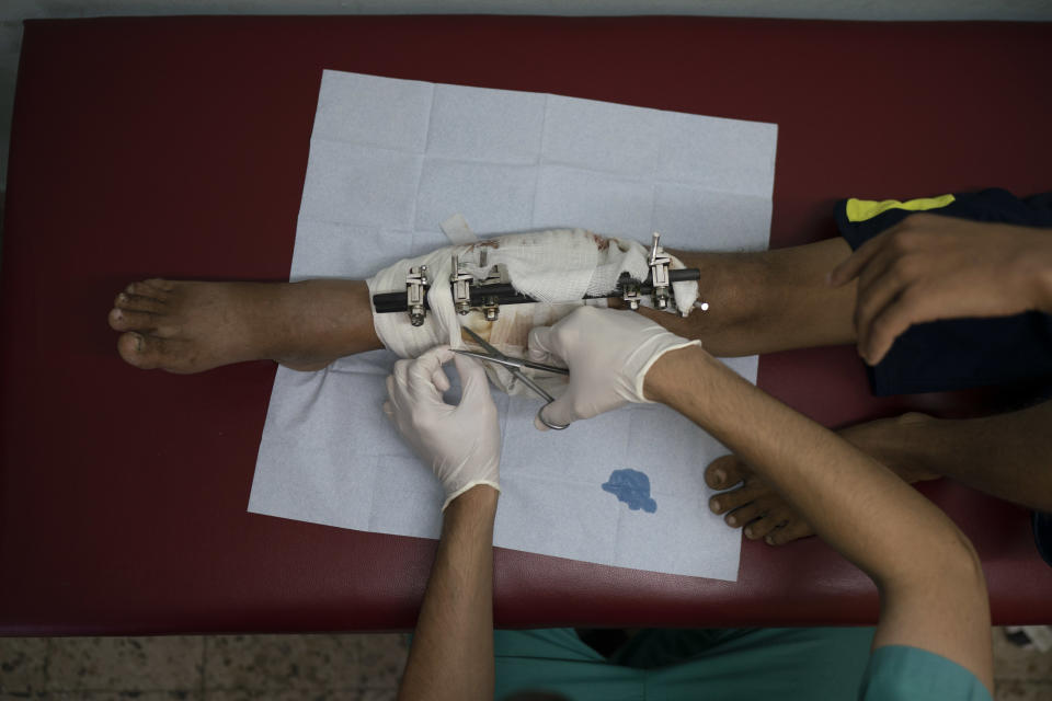 In this Sept. 10, 2018, photo, Mahmoud Abu Assi, who was shot in the leg during a demonstration, has his bandage changed in a clinic run by Doctors Without Borders in Gaza City. Ever since Hamas launched demonstrations in March against Israel's blockade of Gaza, children have been a constant presence in the crowds. Since then, U.N. figures show that 948 children under 18 have been shot by Israeli forces and 2,295 have been hospitalized, including 17 who have had a limb amputated. (AP Photo/Felipe Dana)