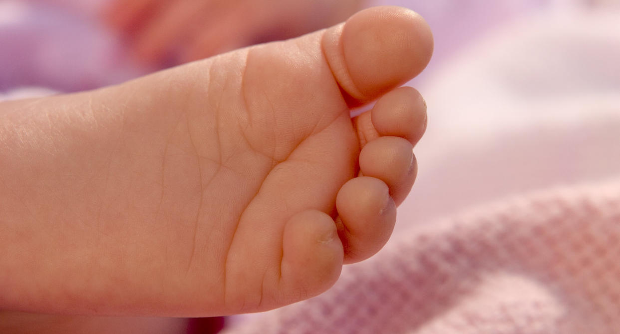 A mother warns parents to check their baby’s feet after amputation scare. (Photo: Education Images/UIG via Getty Images))