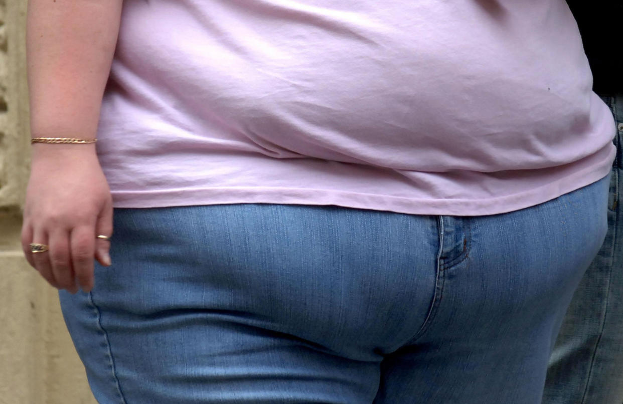 <em>Almost five million teenagers and adults across England, Scotland and Wales will be morbidly obese by 2035 (Picture: PA)</em>