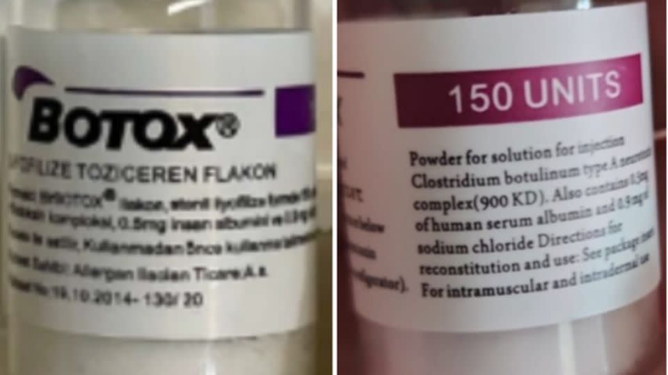 Counterfeit Botox cartons and vials may indicate 150-unit doses, which is not a unit made by the companies AbbVie or Allergan, the FDA said. - FDA