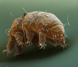 Tardigrade, photo by Oliver Meckes<br>Via <a href="http://www.flickr.com/photos/fei_company/7642349888/in/set-72157630587769114" rel="nofollow noopener" target="_blank" data-ylk="slk:Flickr;elm:context_link;itc:0;sec:content-canvas" class="link ">Flickr</a>