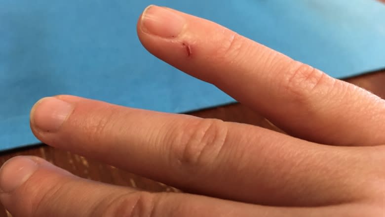 Why do paper cuts hurt so much?