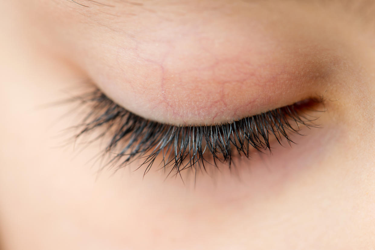 <i>A woman’s eyes were glued shut after a botched salon procedure. Stock photo. [Photo: Getty Images]</i>