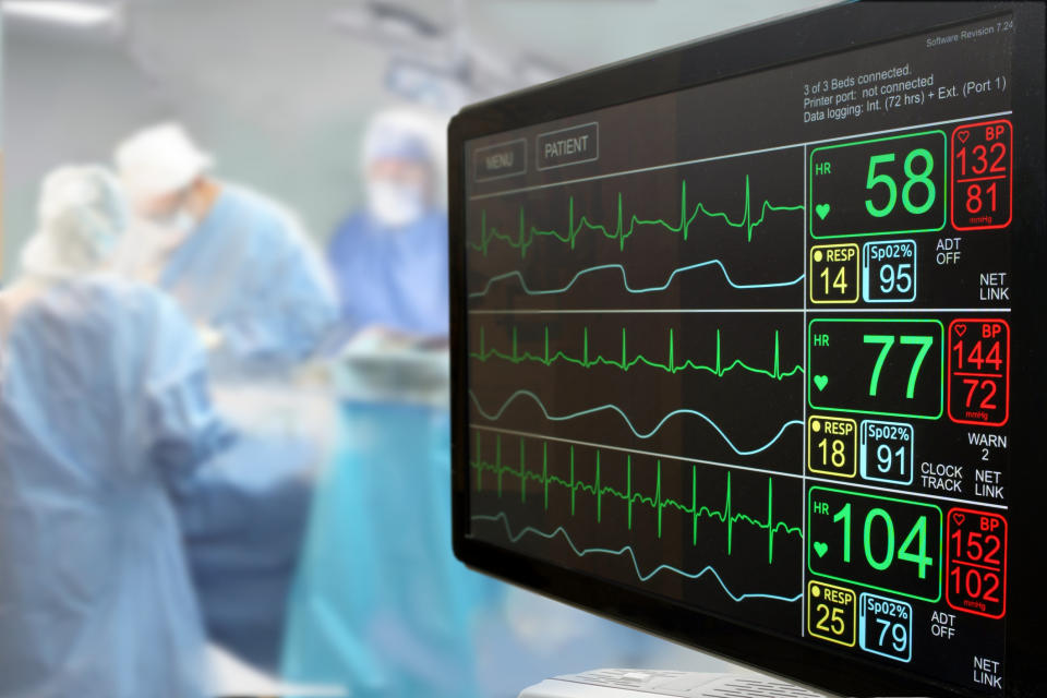 A monitor measuring vital signs in an operating room.