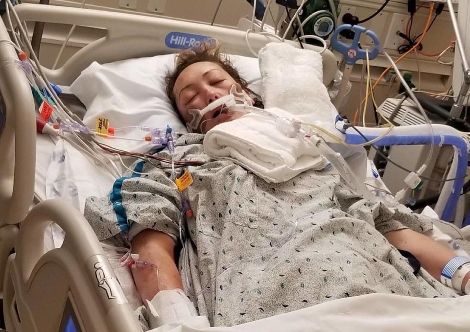 Lauren Kanarek, bleeding out, was taken immediately to the hospital for emergency surgery. Seen here in the hospital with a ventilator, Kenarek says she was in a coma for four days and in the ICU for three weeks.  / Credit: Jonathan Kanarek