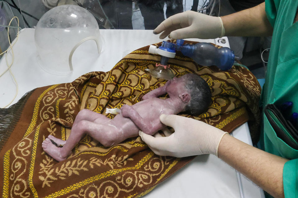 A Palestinian doctor tends to a baby born prematurely after her mother was fatally wounded by an Israeli airstrike in Rafah, Gaza Strip, at the Kuwaiti Hospital in Rafah, April 20, 2024. / Credit: MOHAMMED ABED/AFP/Getty