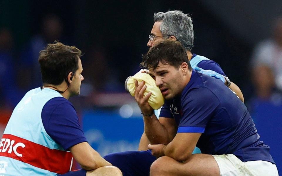 France's Antoine Dupont receives medical attention for a cheek injury against Namibia - France to learn extent of Antoine Dupont injury as fears mount over suspected fracture