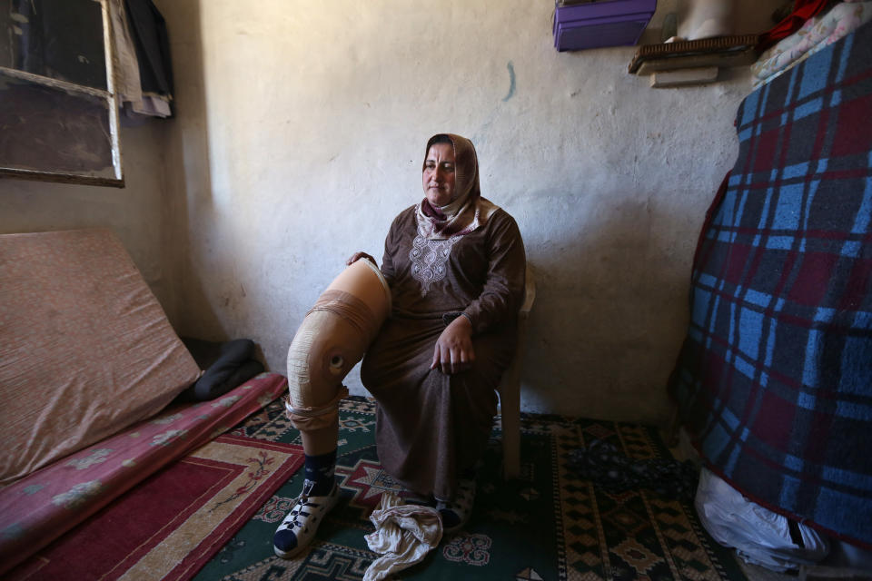 In this Thursday, March 27, 2014 photo, Reem Diab, 34, who lost her leg on Oct. 25, 2012 when a shell slammed into her house in the town of Khan Sheikoun in central Syria, holds her artificial leg in Chtaoura, in the Bekaa valley, east of Lebanon. The shelling killed her husband, Mustafa, and her 15-year-old daughter, Batoul. Syria’s civil war, which entered its fourth year last month, has killed more than 140,000 people. An often overlooked figure is the number of wounded more than 500,000, according to the International Committee of the Red Cross. An untold number of those, there’s no reliable estimate even, have suffered traumatic injuries that have left them physically handicapped. (AP Photo/Bilal Hussein)