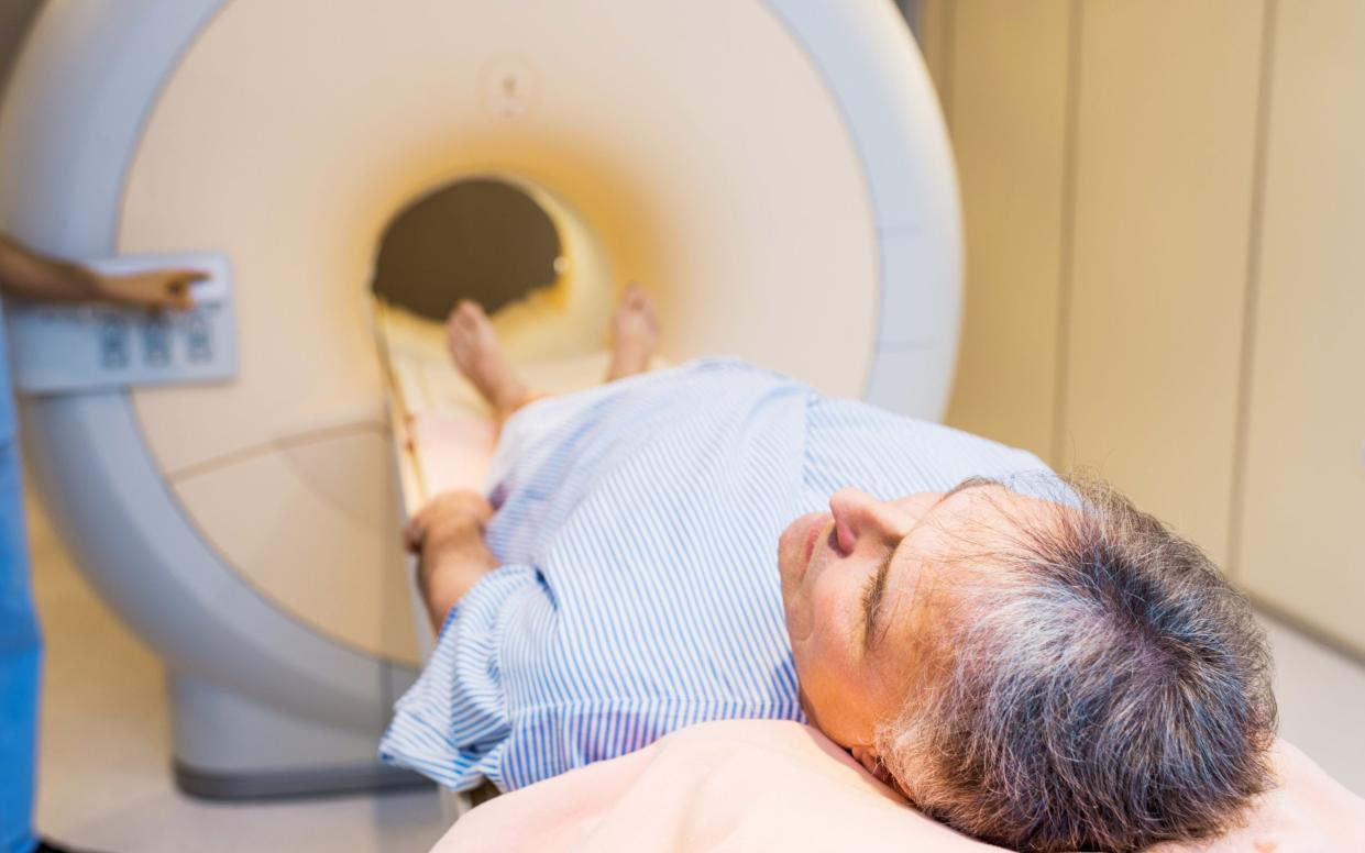 Prostate cancer is the most common cancer among British men - iStock 
