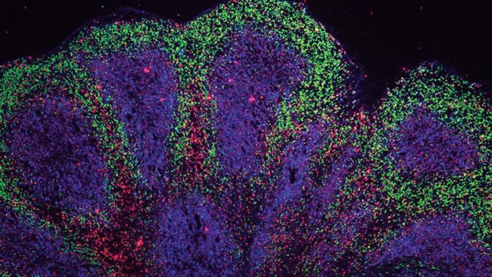 A close-up look at a "mini brain" organoid that scientists grew in order to study neurological diseases.