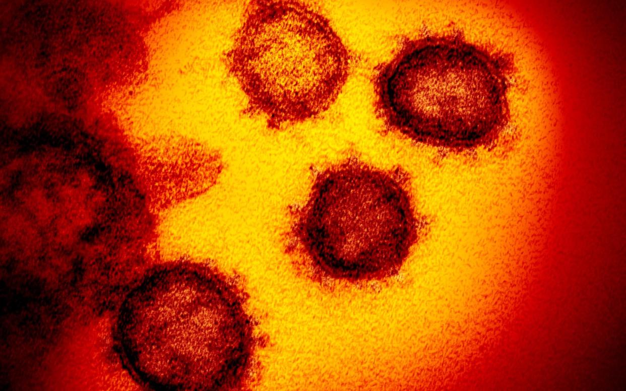 Image of the Novel Coronavirus SARS-CoV-2 - NIAID-RML