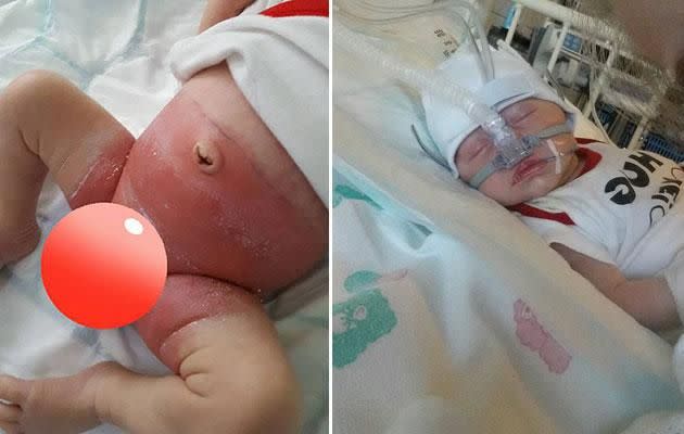 The newborn suffered a horrifying chemical reaction and is in hospital. Photo: Facebook