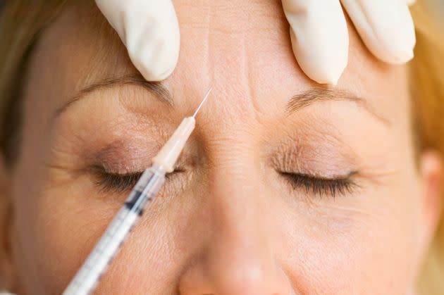 Curious about Botox? We asked experts what you need to know.  (Photo: Rick Gomez via Getty Images)
