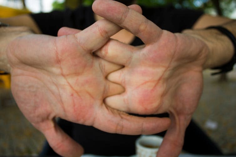 <span class="caption">Cracking your knuckles won’t cause arthritis.</span> <span class="attribution"><a class="link " href="https://www.shutterstock.com/download/confirm/1124065478?size=medium_jpg" rel="nofollow noopener" target="_blank" data-ylk="slk:rfranca/Shutterstock;elm:context_link;itc:0;sec:content-canvas">rfranca/Shutterstock</a></span>