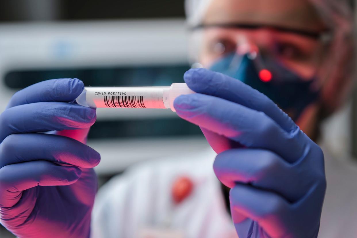 lab technician holding a positive sample of covid-19