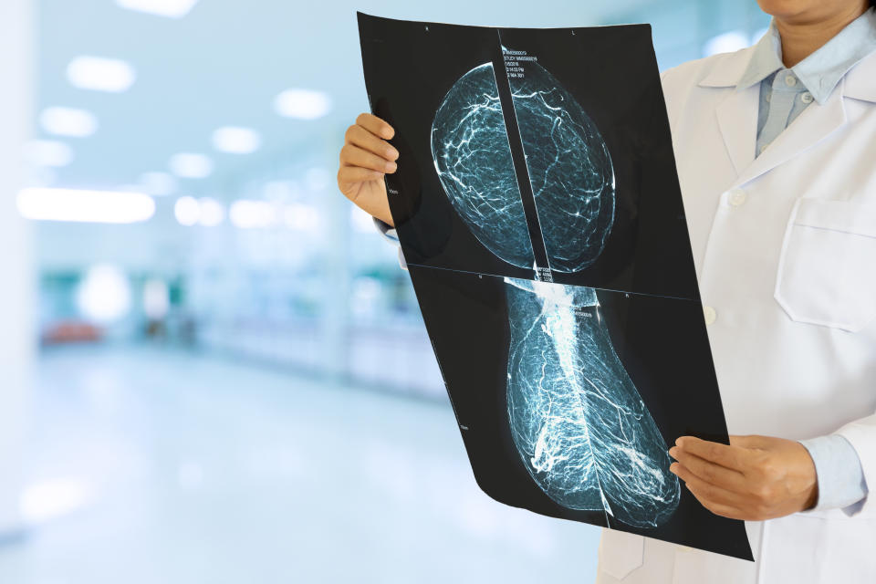 A mammogram — an x-ray of the breast — is used to help health-care professionals detect breast diseases. (Photo via Getty Images)
