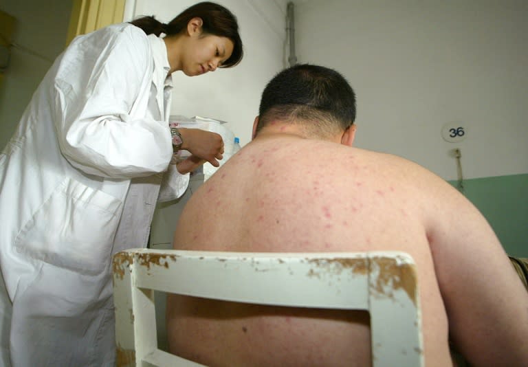 The average Chinese man weighed 66.2 kilograms (146 pounds) in 2012, having put on an average 3.5 kilograms over 10 years, according to a government report