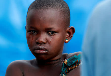 Mave Grace, 11, who had part of her arm chopped off by militiamen when they attacked the village of Tchee, stands in an Internally Displaced Camp in Bunia, Ituri province, eastern Democratic Republic of Congo, April 12, 2018. REUTERS/Goran Tomasevic